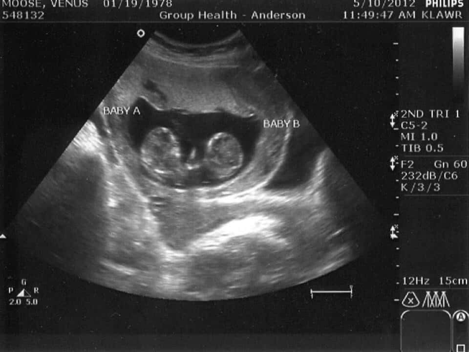 Three years ago today, we received the surprising news that our family would be increasing by two. Amazing!