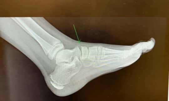 Abby’s sporting a new accessory, unfortunately.